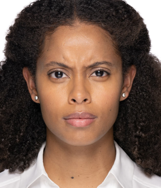 Other Aesthetic Treatments-before