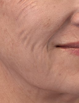 Turn back the clock on firmer skin