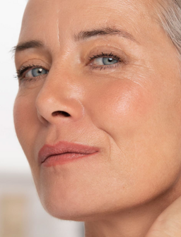 Concerns_FineLines_and_wrinkles
