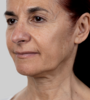 Iride