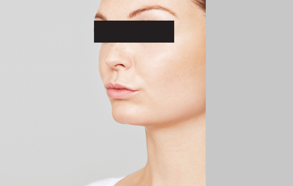Cassandra Before