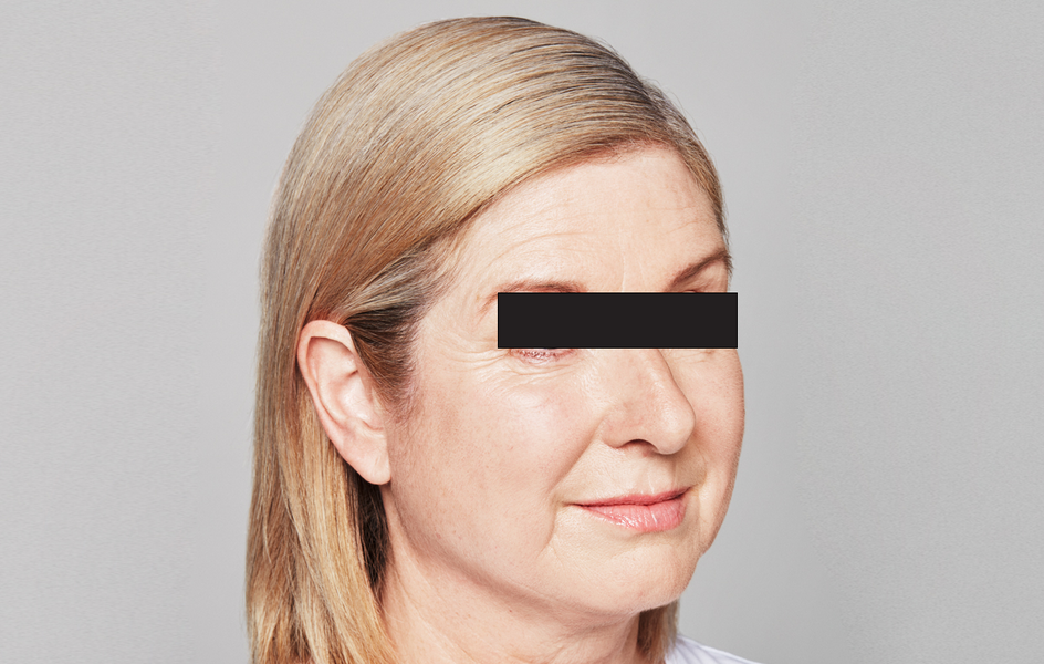 Catherine Before