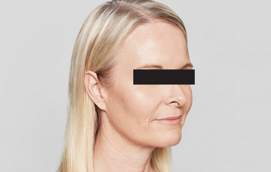 Sanne After