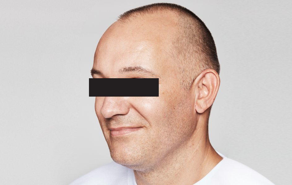 Yohan After