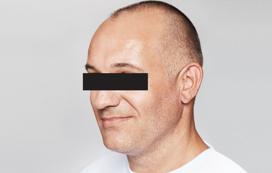 Yohan Before