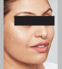 Rafat Before