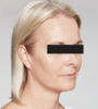 Sanne Before