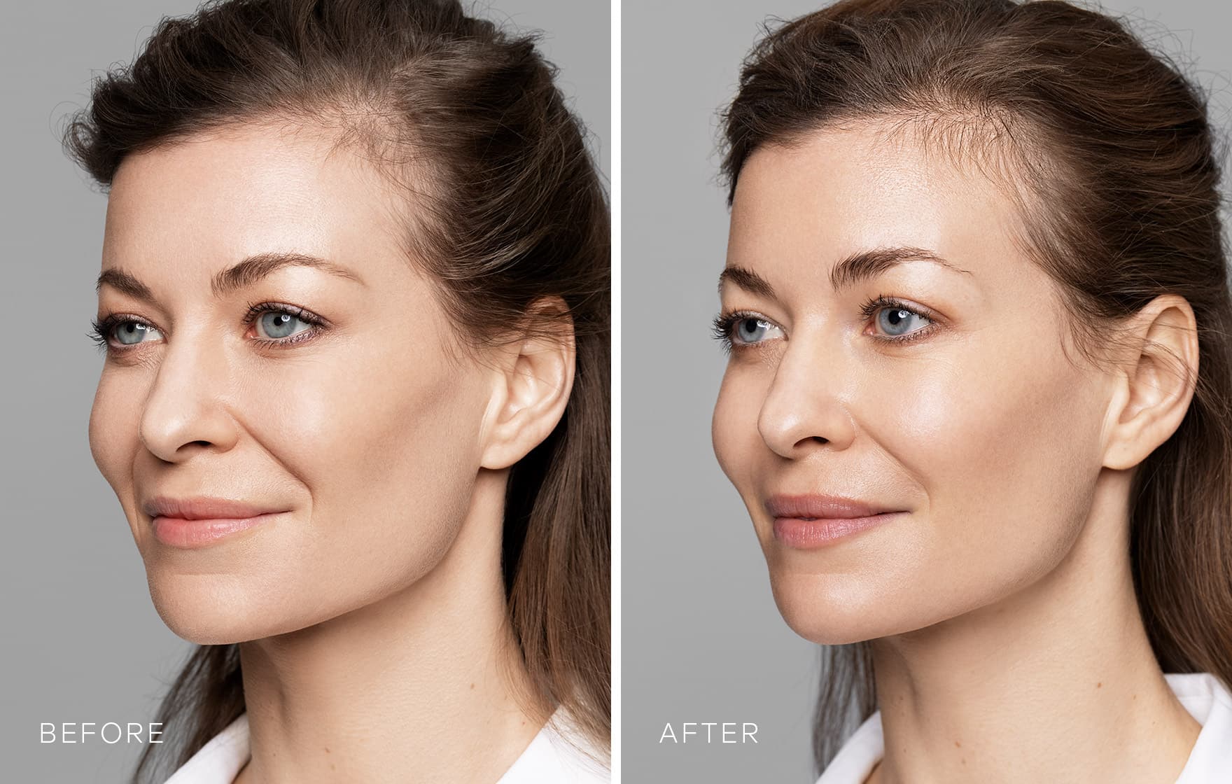 Will lips feel natural or not with HA lip fillers?