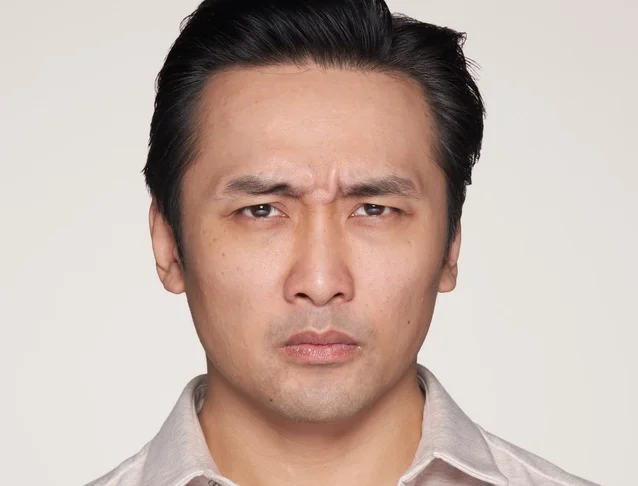 consumer_v3_home_otheraesthetictreatments_frownlines_basmall_aaron_before.jpg