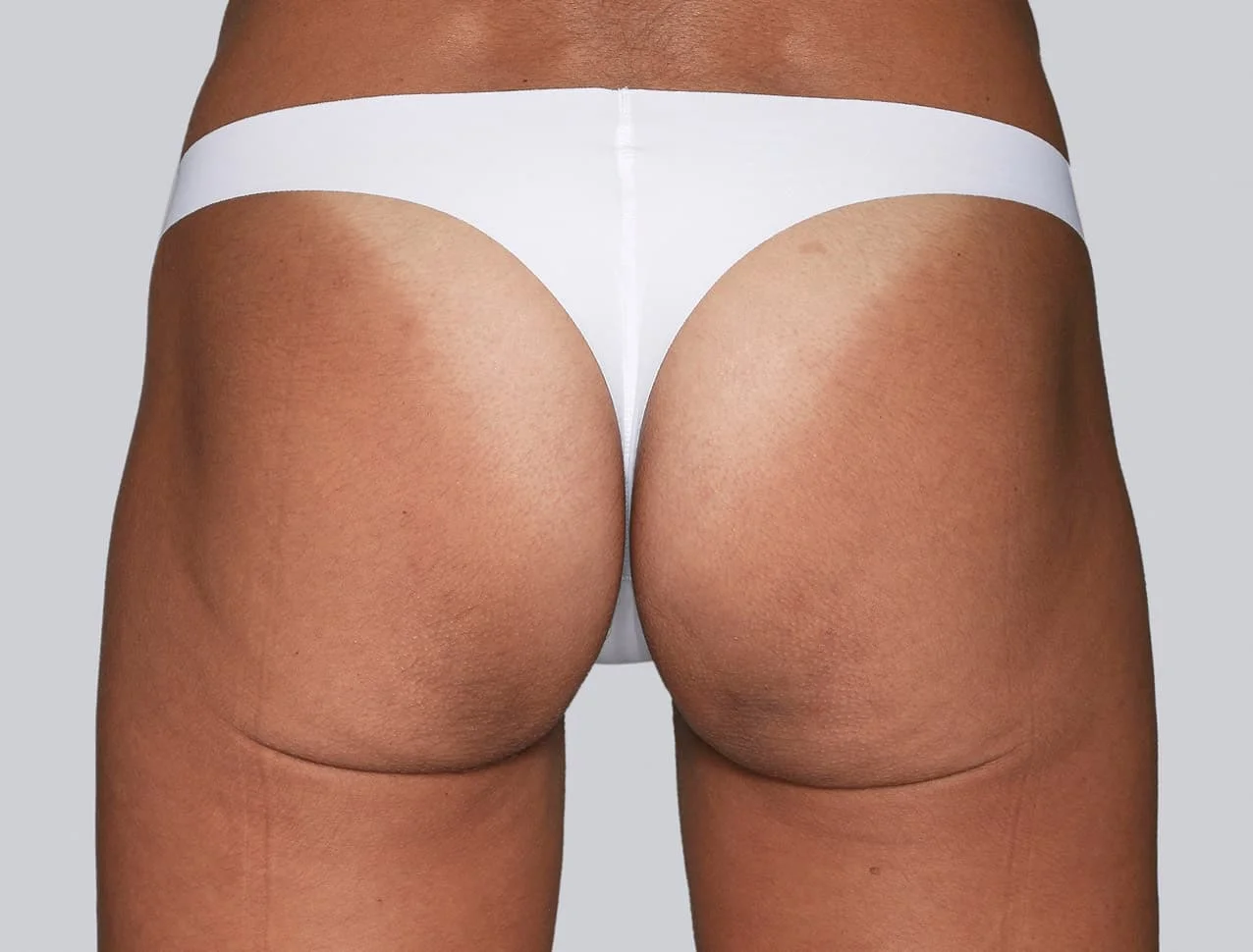 sculptra_body_basmall_valeria_after_0