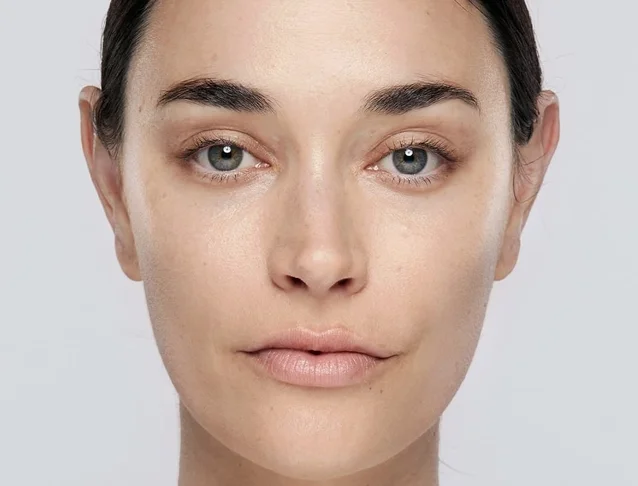Restylane_CategoryPage_BABanner_Georgia_Before