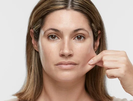Sculptra_CategoryPage_BannerLarge_BA_Before.jpg