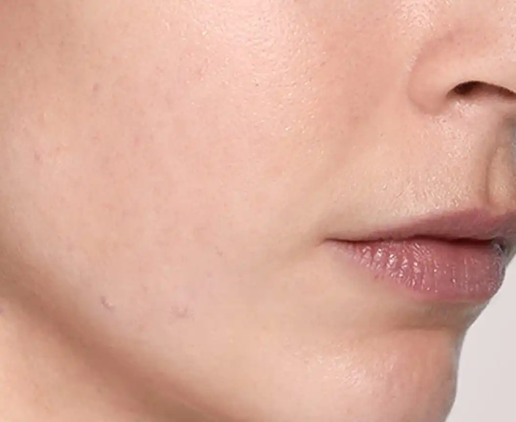 Skinboosters_CategoryPage_BannerLarge_After