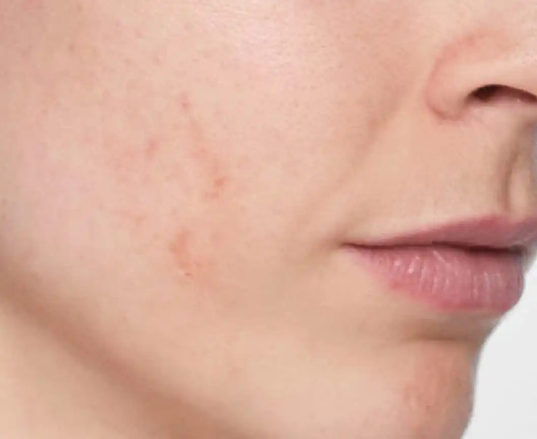Skinboosters_CategoryPage_BannerLarge_Before