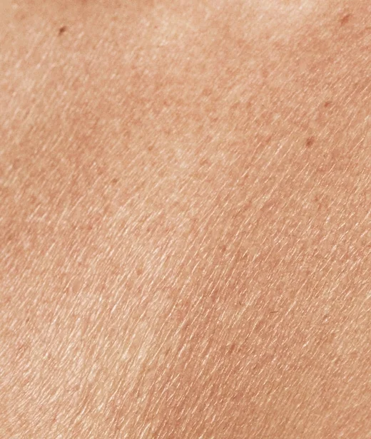 concerns_dryskin_dryskincanhappen