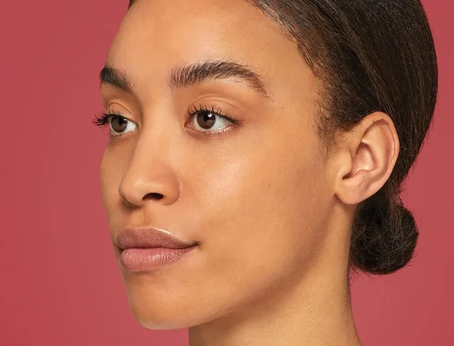 consumer_v3_restylane_cheeks_ba_maya_before
