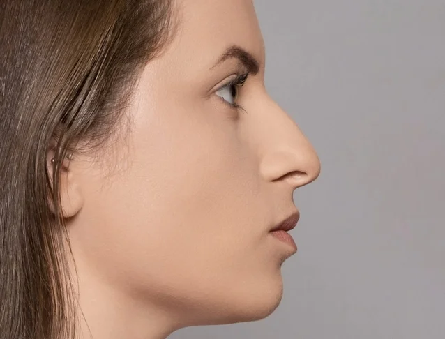 consumer_v3_restylane_nose_basmall_rayssa_before