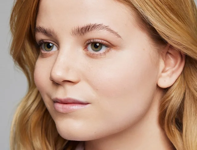 consumer_v3_restylane_undereyes