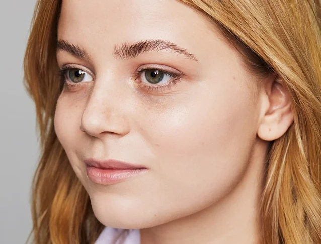 consumer_v3_restylane_undereyes