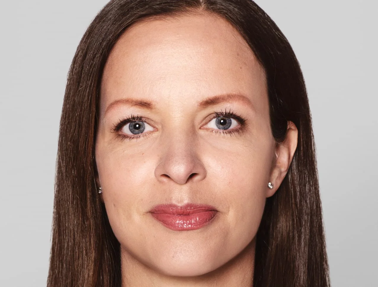 consumer_v3_skinboosters_face_basmall_anna_after