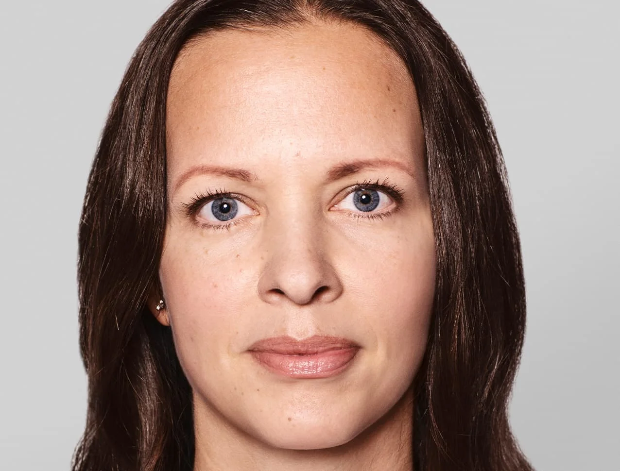 consumer_v3_skinboosters_face_basmall_anna_before