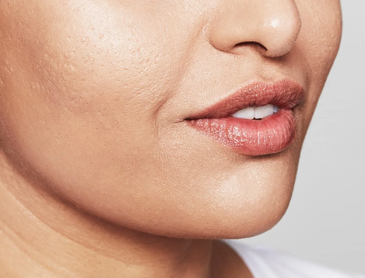 consumer_v3_skinboosters_face_basmall_rafat_after