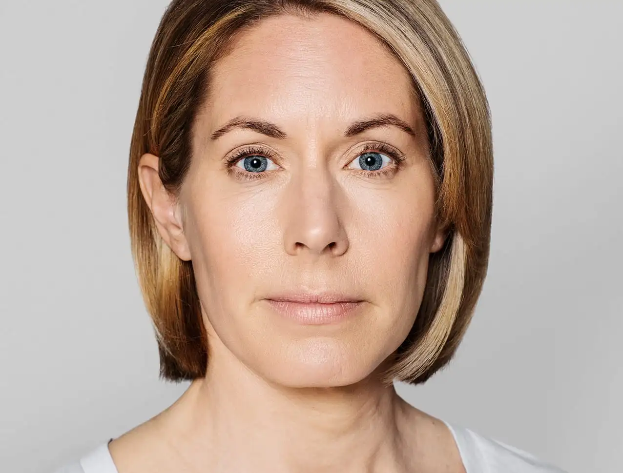 consumer_v3_skinboosters_neck_basmall_jenny_after
