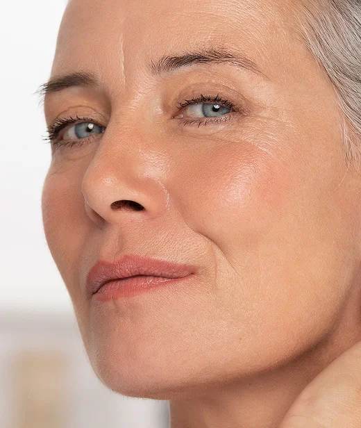 Signs of fine lines