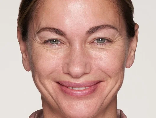 otheraesthetictreatments_categorypage_bannerlarge_left