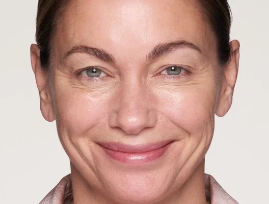 otheraesthetictreatments_categorypage_bannerlarge_right
