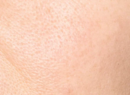 skin_texture