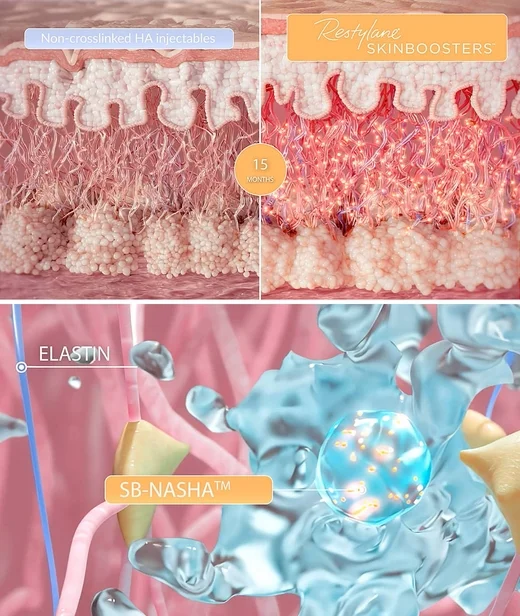 skinboosters_science_restoringhydration