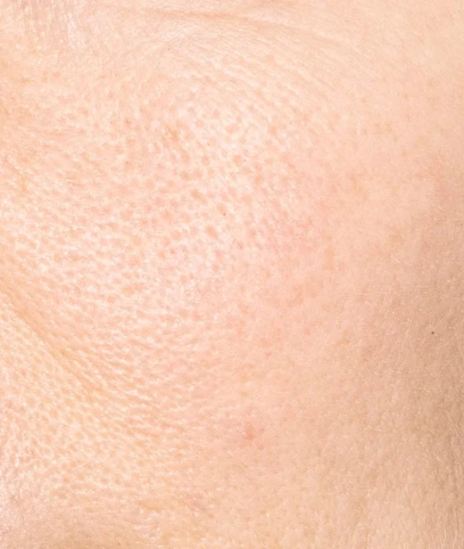 skinconcern_skintexture_whatisskintexture