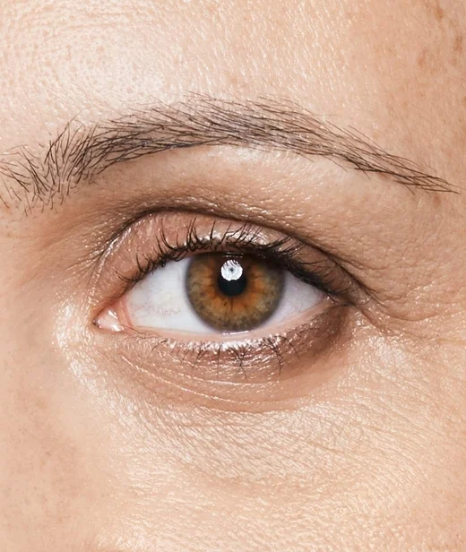 skinconcerns_undereyes_darkcircles_acommonconcernformany