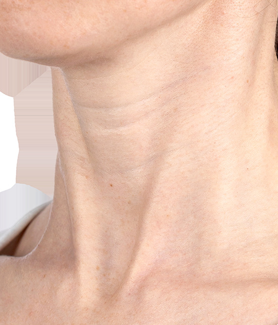 ASSET-RES-5015_content_b&a_cropped.webp