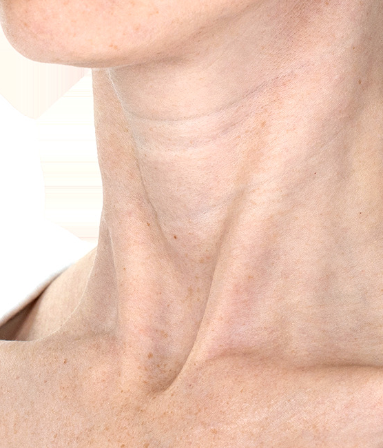 ASSET-RES-5016_content_b&a_cropped