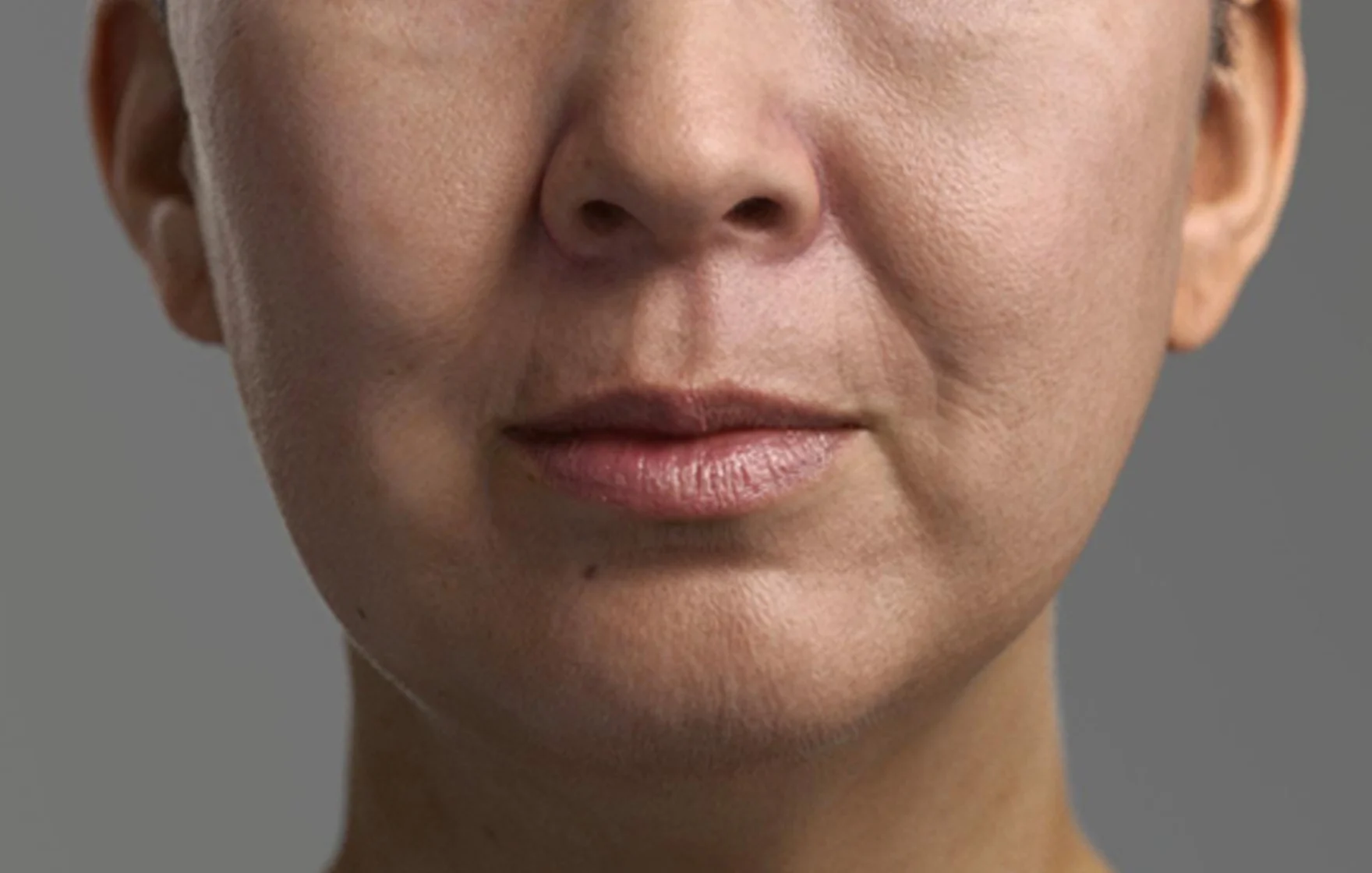 Collagen loss leads to weakened structural support