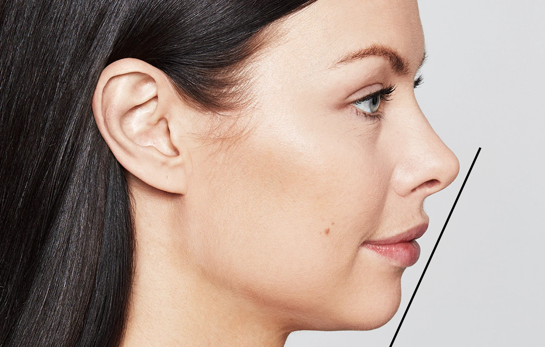 Article: How to reshape aging and thin lips - Irina