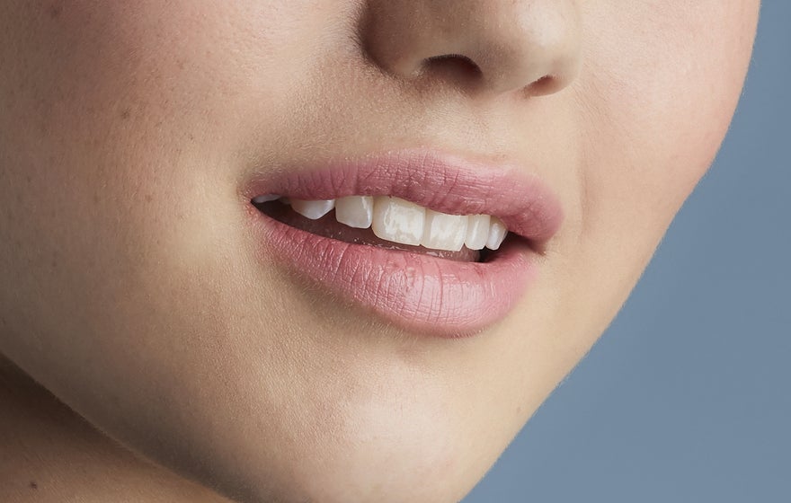 Restylane®Kysse™—a lip filler that makes your partner want to kiss you more