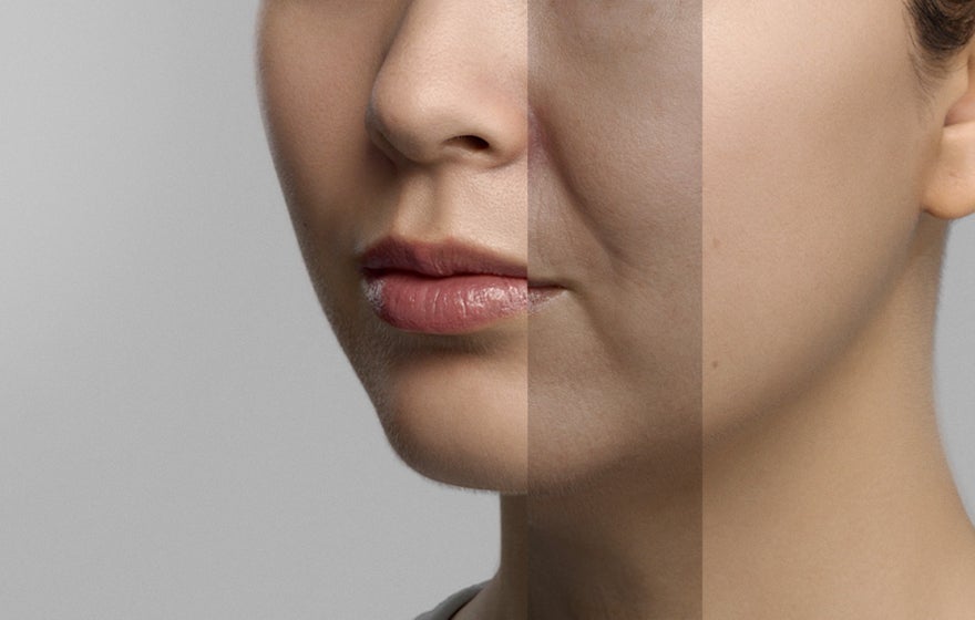 Skin concerns and treatments at different age ranges with Galderma Aesthetics
