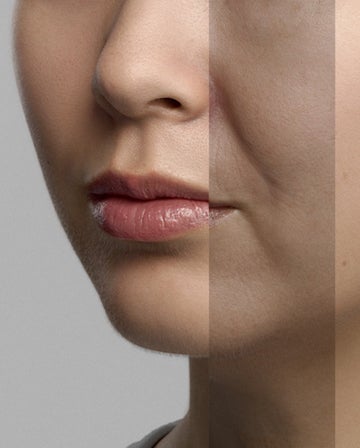 Skin concerns and treatments at different age ranges