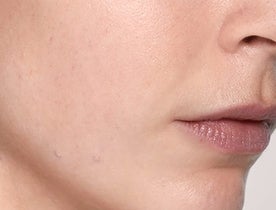 Skinboosters_CategoryPage_BannerLarge_After