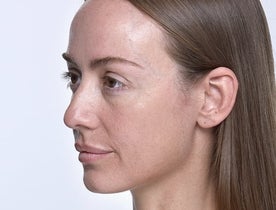 Kerri_Before