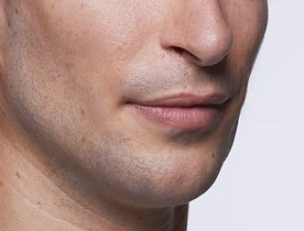Lewis_After