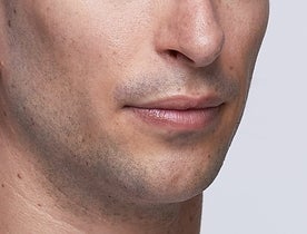 Lewis_Before