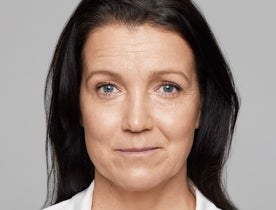 Consumer_V3_Skinboosters_Face_BAsmall_Mirjam_Before