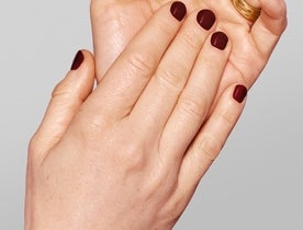 Consumer_V3_Skinboosters_Hands_BAsmall_Mikaela_after