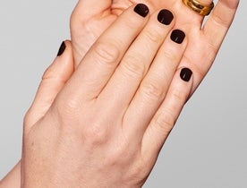Consumer_V3_Skinboosters_Hands_BAsmall_Mikaela_before