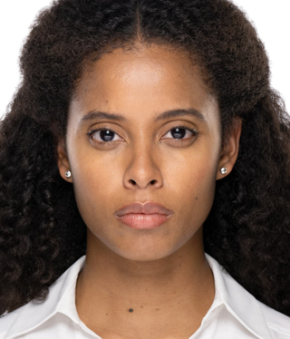 Other Aesthetic Treatments-after