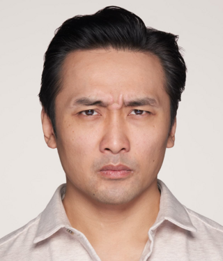 Other Aesthetic Treatments-before